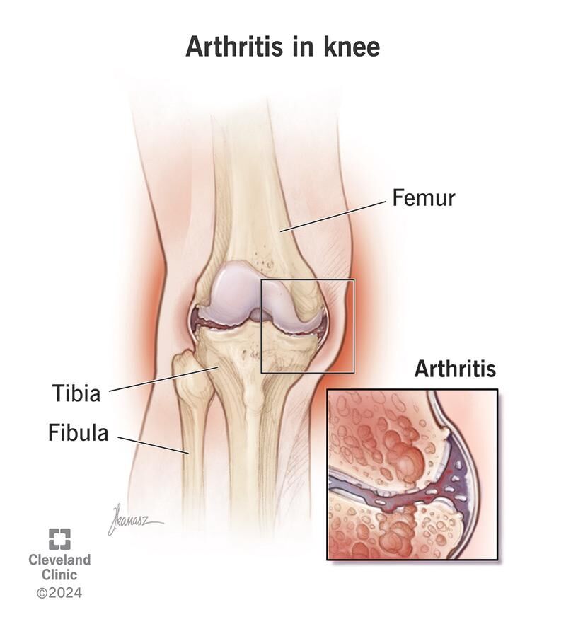 Best Orthopedic Doctor in Hubli Shares 7 Trusted Knee Pain & Joint Care Tips – Dr. Anmol Hublikar